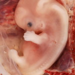 800px-9-Week_Human_Embryo_from_Ectopic_Pregnancy